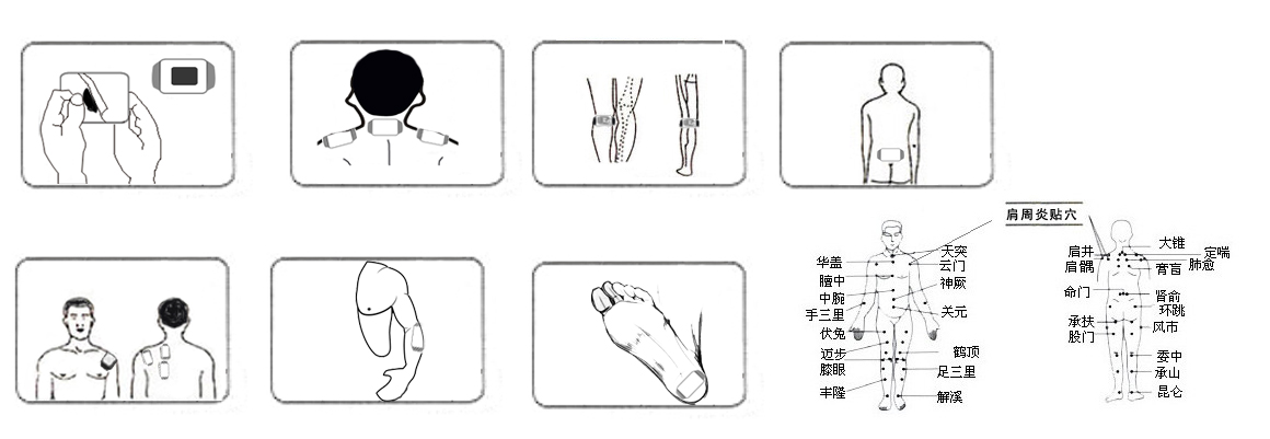 穴位贴敷治疗贴(图2)