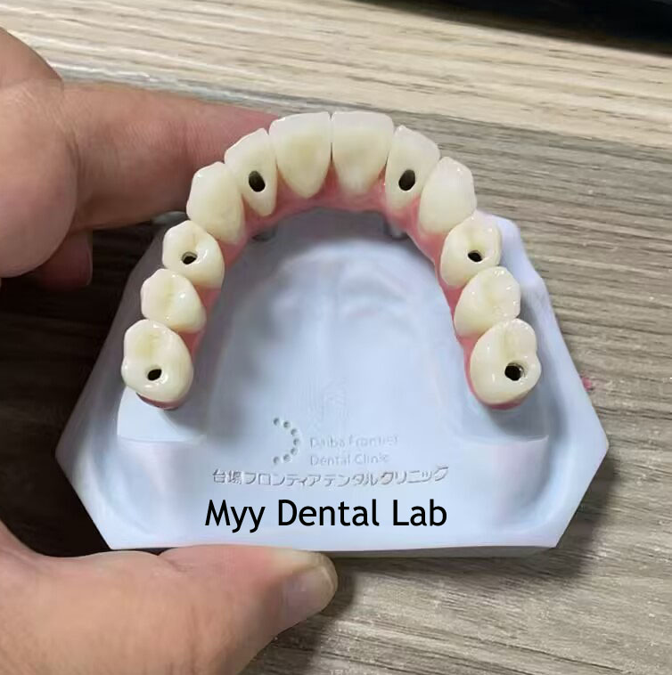 加拿大义齿工厂直销 - 全口义齿与种植牙国际代工